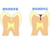 阳泉销量好的基础牙科中心【荐】，微创拔牙
